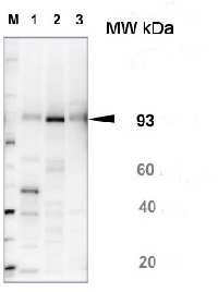 SUS1 | Sucrose synthase 1 in the group Antibodies Plant/Algal  / Carbohydrates at Agrisera AB (Antibodies for research) (AS15 2830)